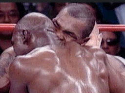 Telinga Anak Ini Digigit Teman Sendiri hingga Putus