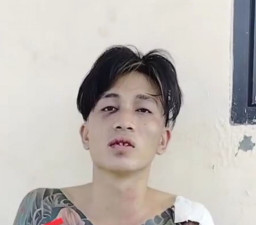 Pria Bertato Tusuk Bayi 2 Tahun hingga Ususnya Terburai