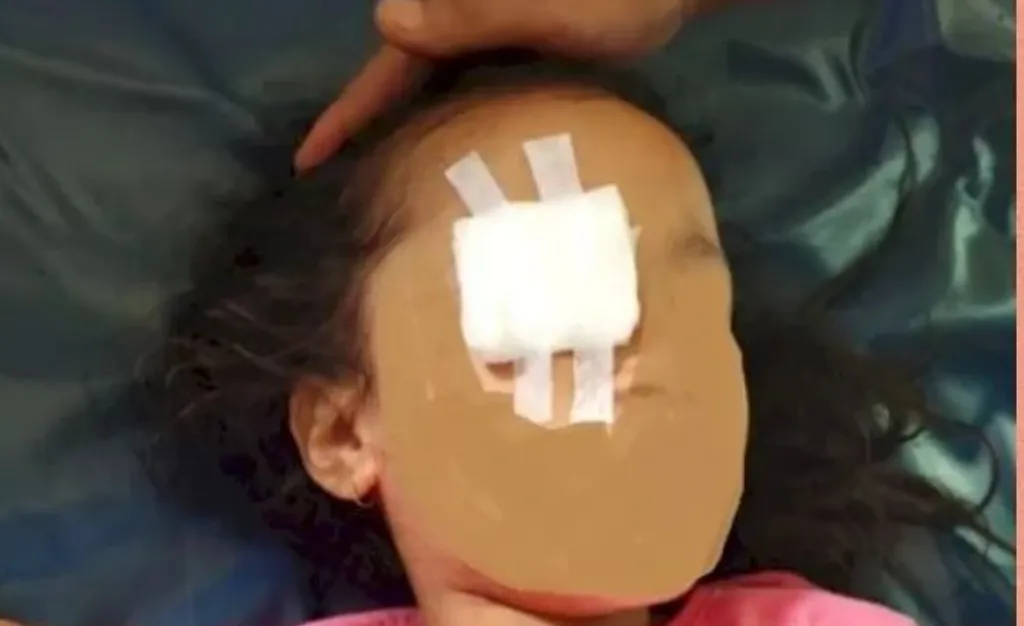 Adik Korban Pencungkilan Mata oleh Ibu Kandung, Tewas Dicekoki Air Garam