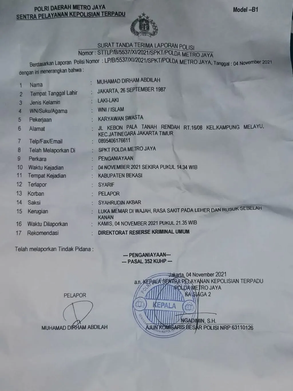 PL Proyek Bumdes Lambang Sari Diduga Aniaya Jurnalis, FWJ: Polisikan!