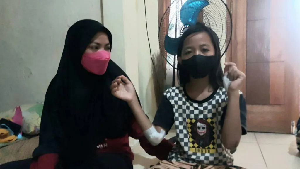 HP Dijambret, Siswi Kelas 6 SD Terseret Cium Aspal