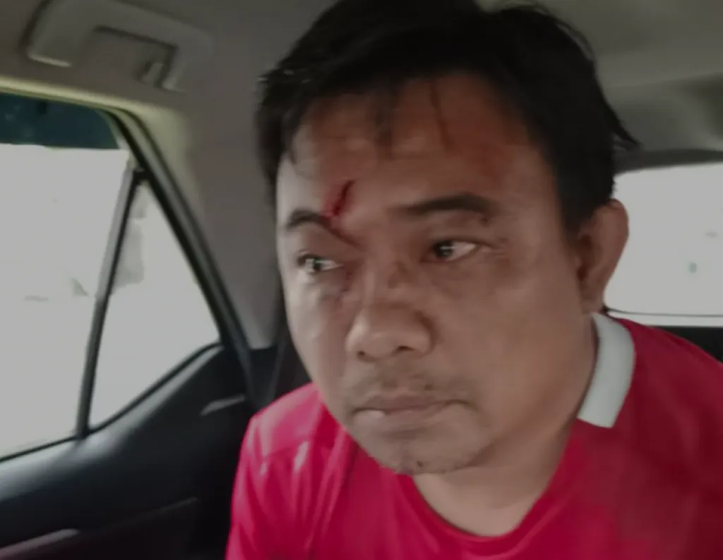 Jelang Bersaksi Dalam Sidang Ferdinand Hutahean, Ketum KNPI Dikeroyok OTK