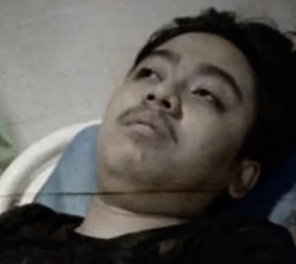 Dibacok Geng Motor, Tangan dan Kaki Radja Nyaris Putus