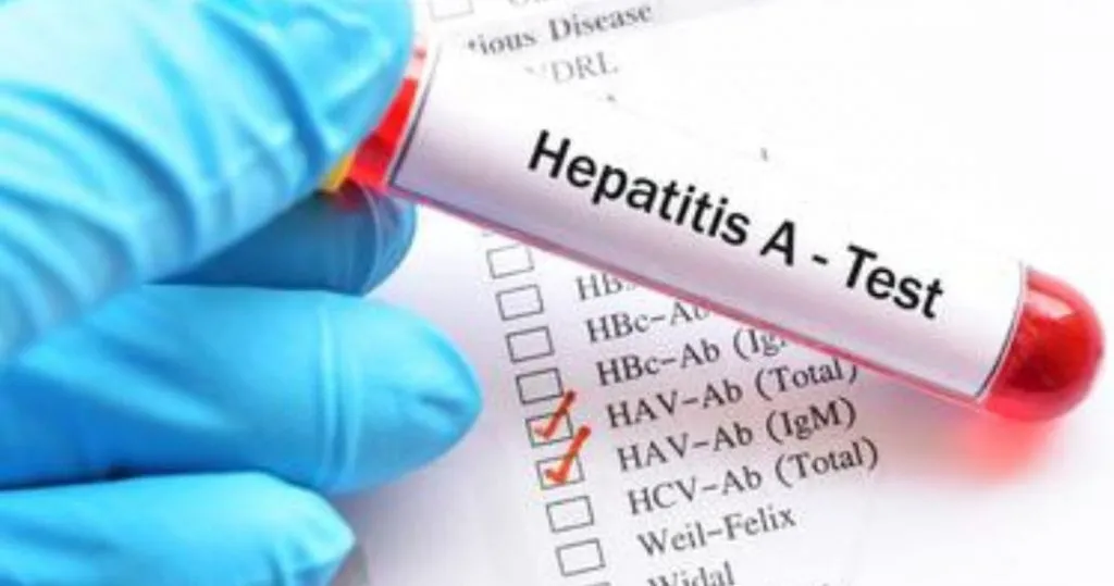 Ponorogo Waspada Wabah Hepatitis Akut