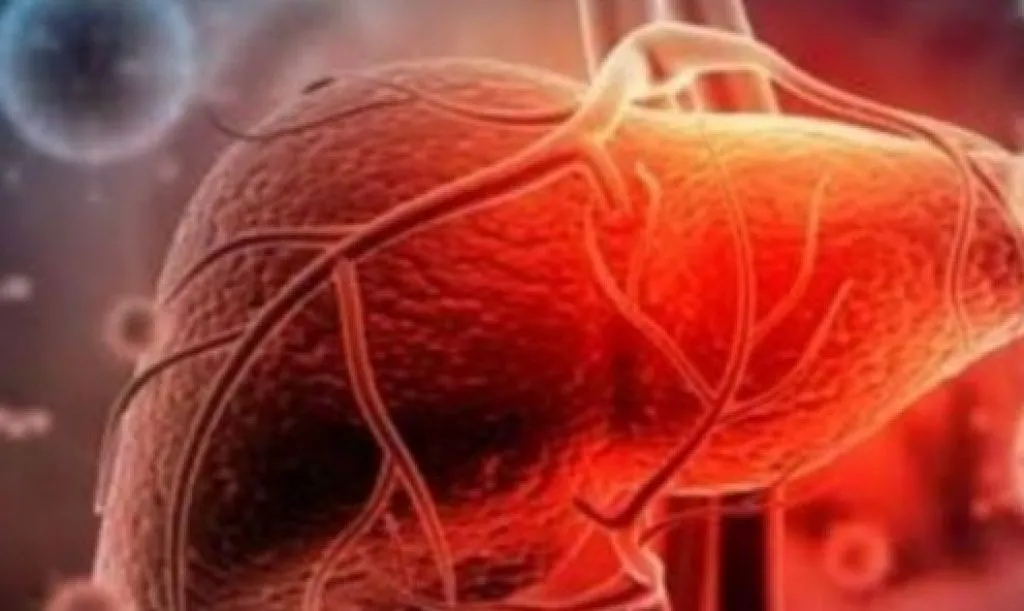 Hepatitis Akut Kemungkinan Ada Kaitannya dengan Covid 19