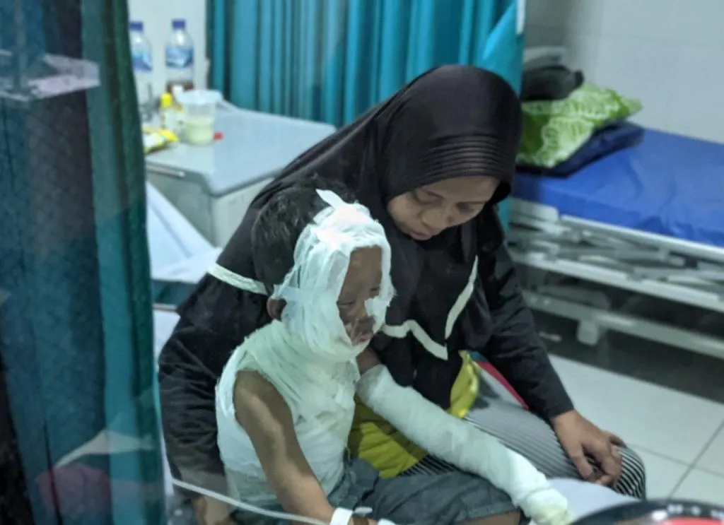 Es Ciki Kebul Makan Korban, Tubuh Bocah 5 Tahun di Ponorogo Terbakar