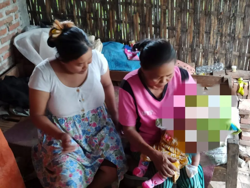 Bayi tanpa Tempurung Kepala di Ponorogo Tunggu Uluran Tangan