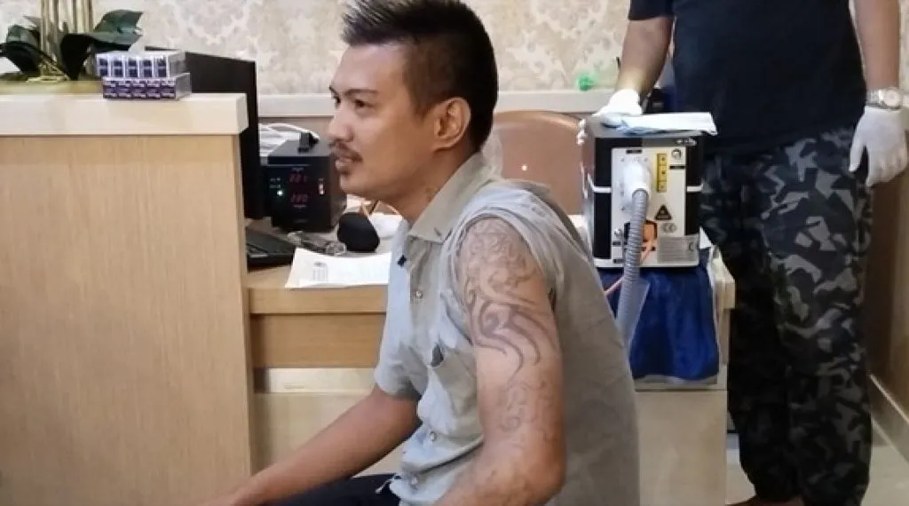Hapus Tato di Badan, Puluhan Warga di Lamongan Mengaku Sakit dan Menyesal
