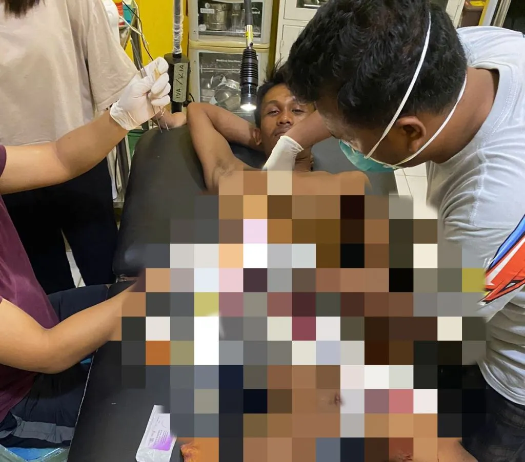 Ditikam saat Menjemput Isteri, Doni Terluka di Bagian Perut