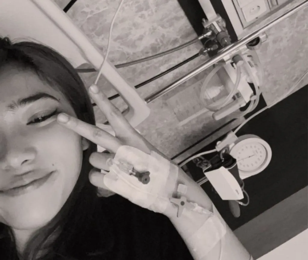 Isyana Sarasvati Kena Lupus