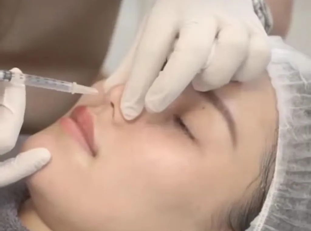 Lebaran, Ayu Ting Ting Pamer Hidung Baru