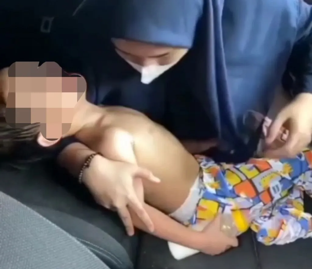 Bocah 4 Tahun Diduga Dianiaya Guru PAUD hingga Tulangnya Patah
