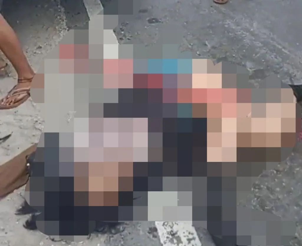 Kendarai Motor Ditabrak Mobil dari Belakang, Kaki Wanita Ini Menekuk ke Atas