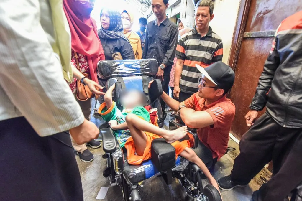 Pemkot Surabaya Bantu Anak Penderita Cerebral Palsy di Dinoyo