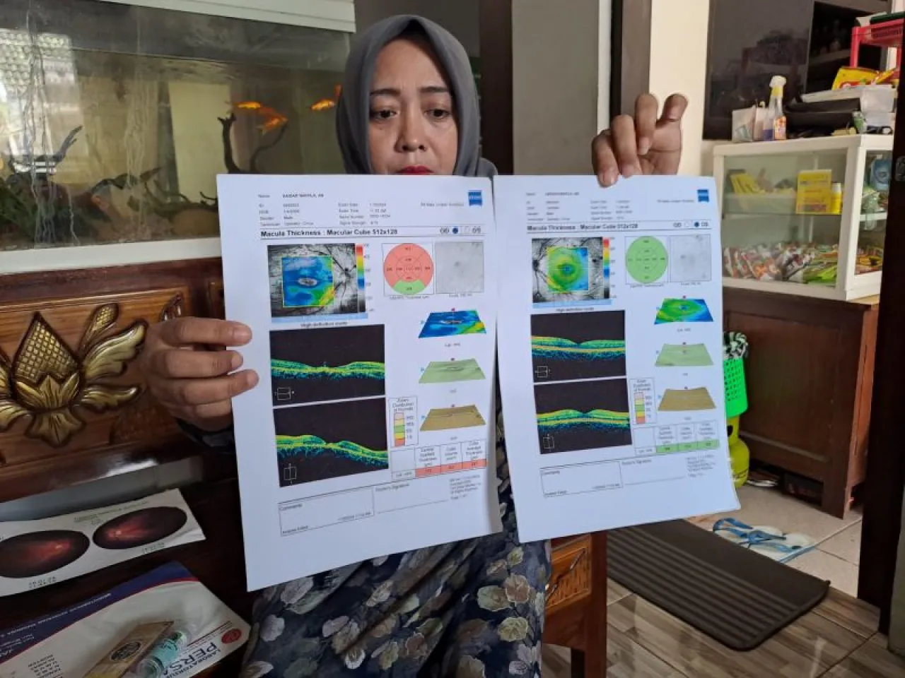 Pelajar SD Nyaris Buta Kena Lemparan Kayu di Jombang, Ganti Rugi Dinilai Tak Sepadan