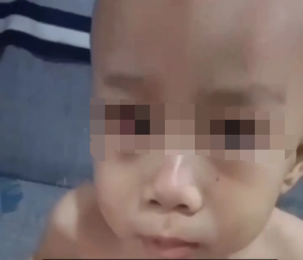 Bocah Ini Disiksa Ayah Tiri hingga Badannya Penuh Lebam dan Matanya Memerah