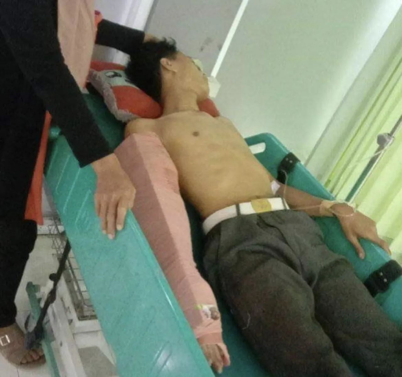 Melintas di Jalan Sepi, Tangan Nyaris Putus Disabet Begal