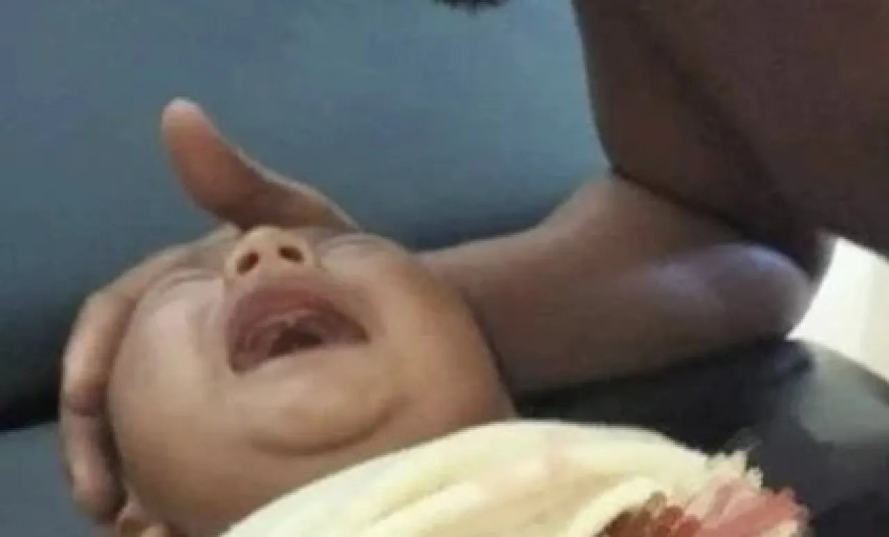 Ditinggal Sholat Dzuhur, Bayi 2 Bulan Diserang Monye hingga Perutnya Sobek