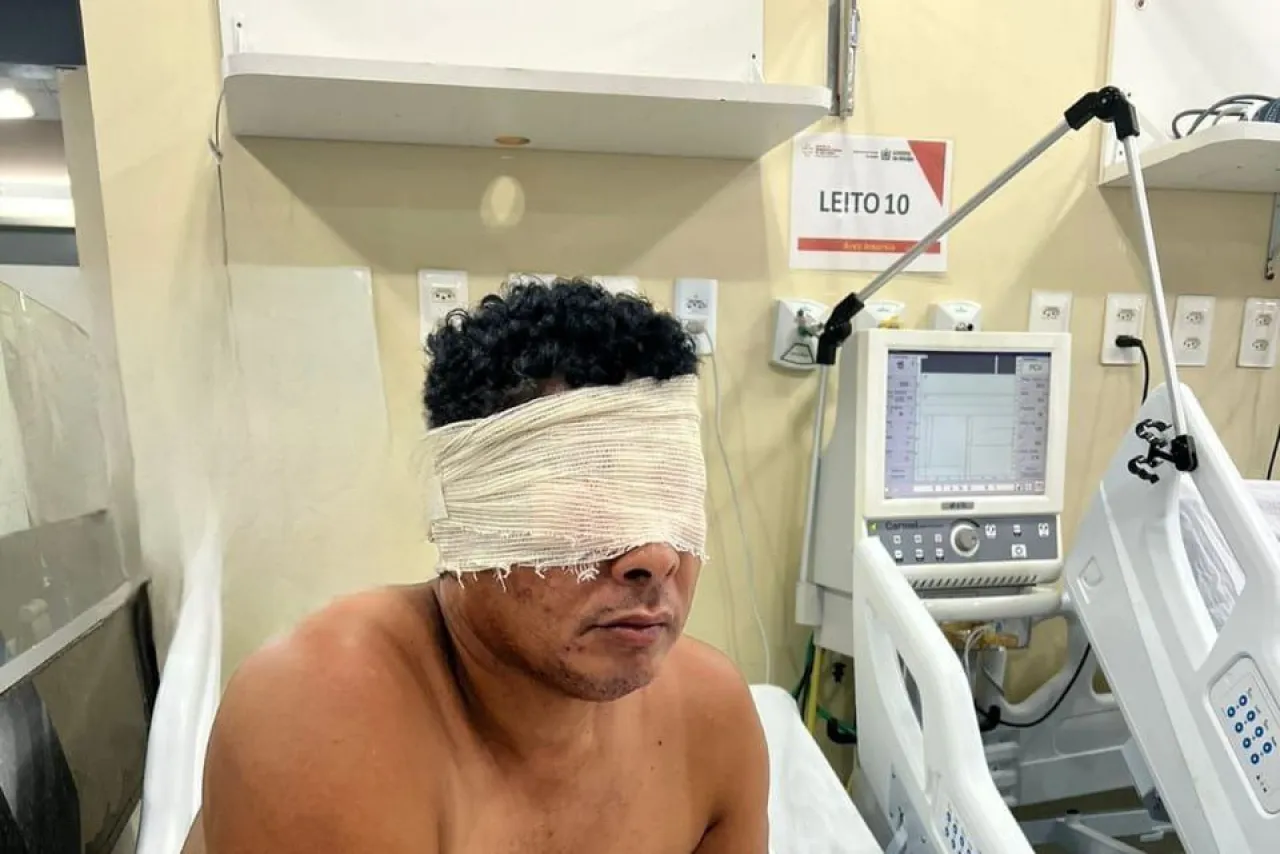 Menderita Skizofrenia, Pria Ini Congkel Mata Sendiri
