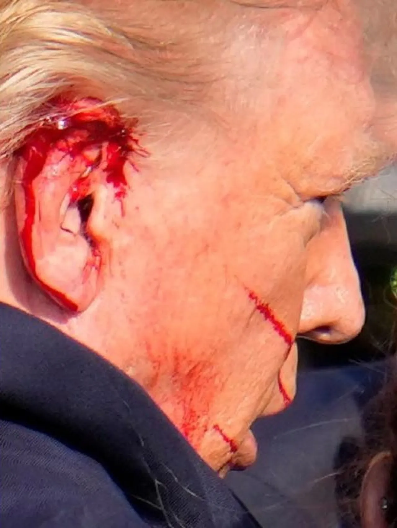 Donald Trump Sudah Keluar dari Rumah Sakit