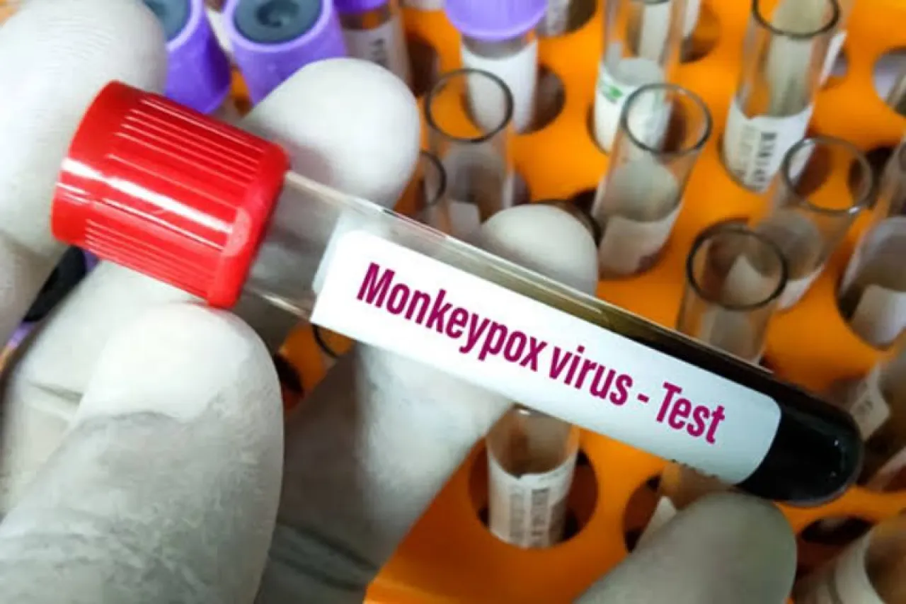 Jadi Basis BMI, Ponorogo Waspada Virus Monkeypox