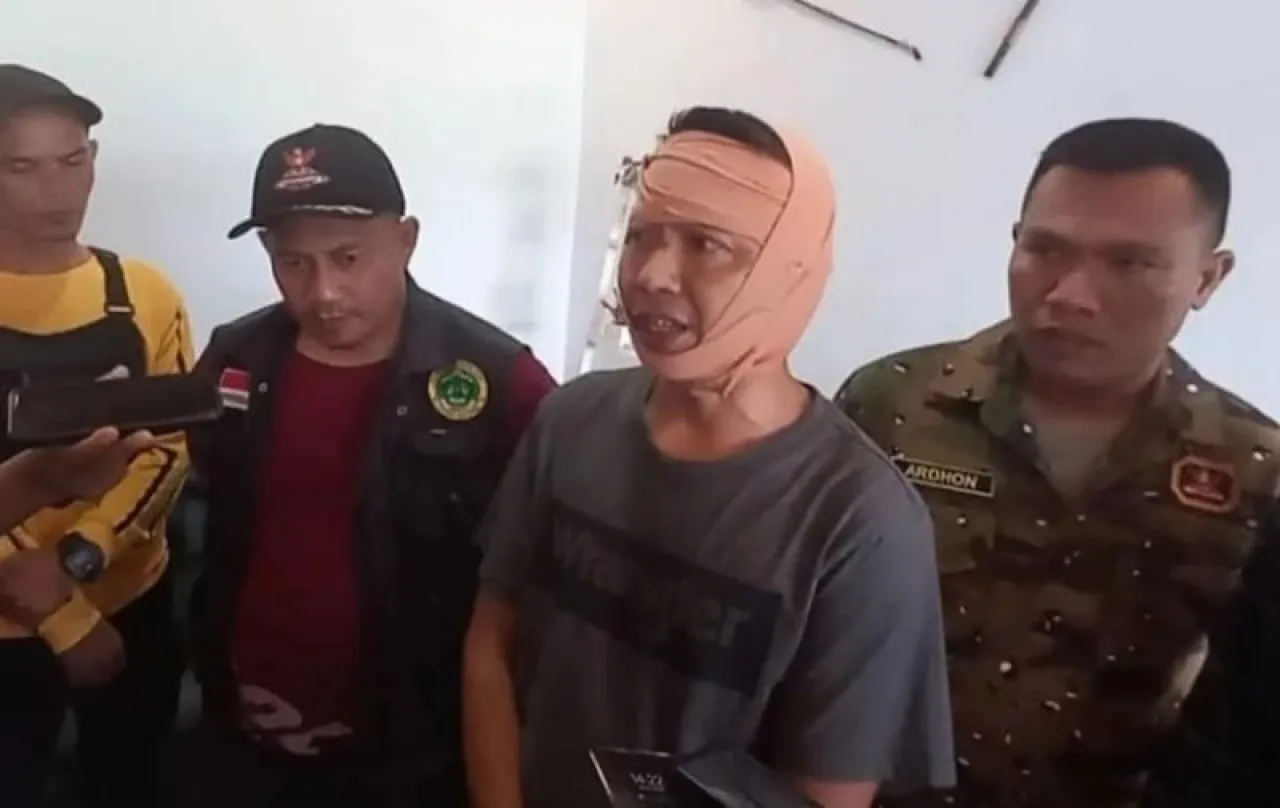 Analisa Rekaman CCTV, Polisi Terus Dalami Kasus Pengeroyokan Anggota GRIB Jaya Depok