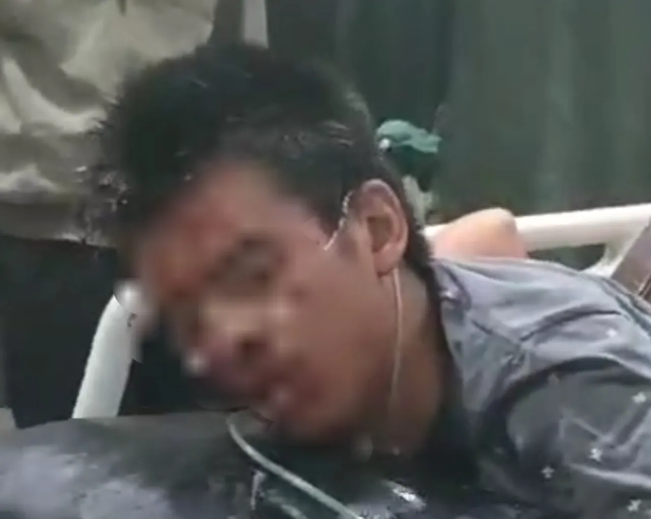 Remaja Tertusuk Senjata Teman Sendiri saat Kabur Usai Tawuran Waktu Sahur 