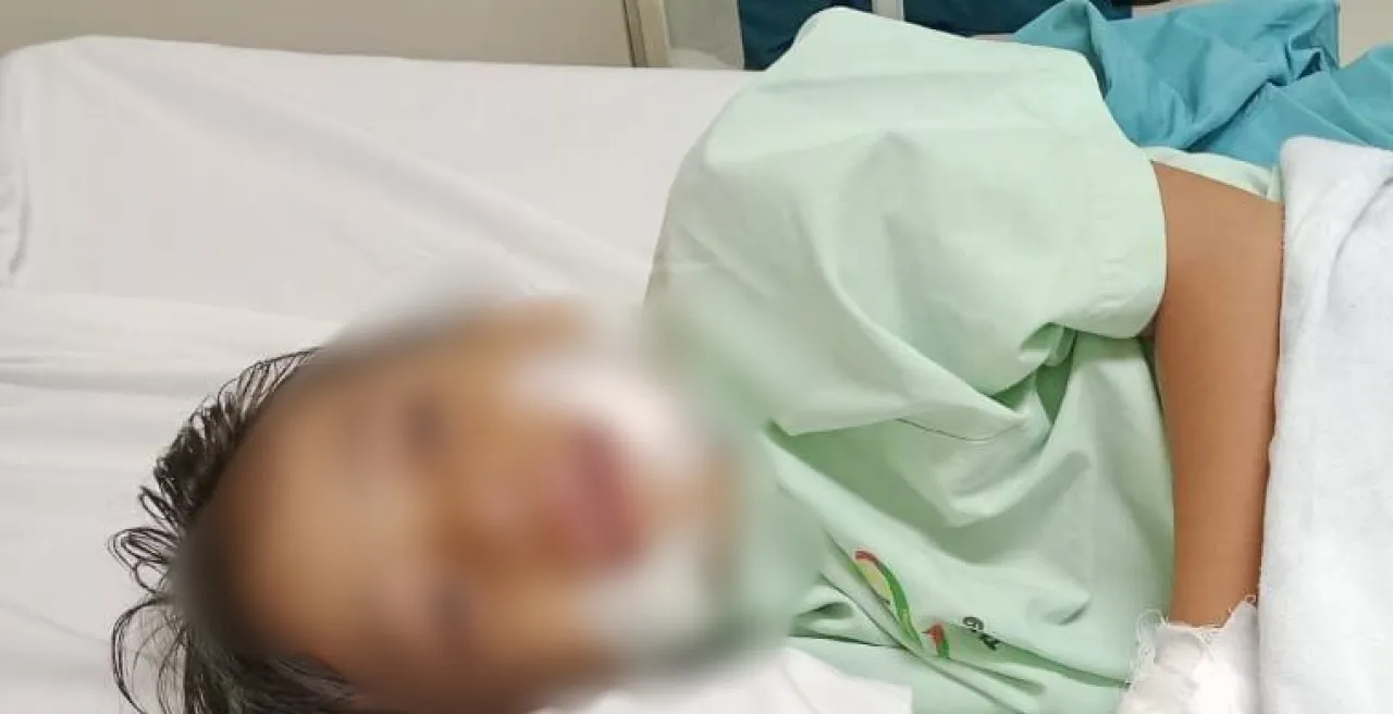 Kena Benang Layang-layang, Mulut Bocah Perempuan di Banjarmasin Luka Cukup Parah
