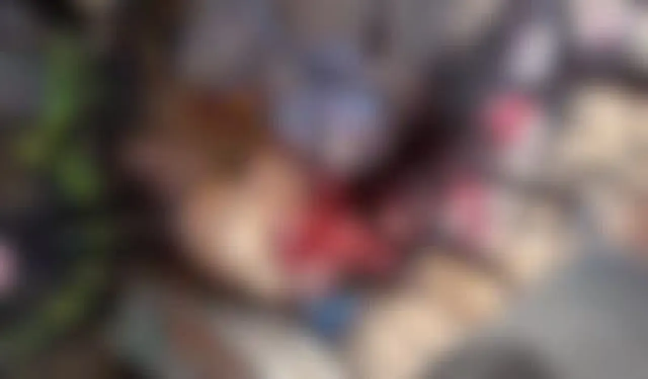Carlos Ditemukan Tewas dengan Kondisi Kepala Bekas Dipukul Kapak