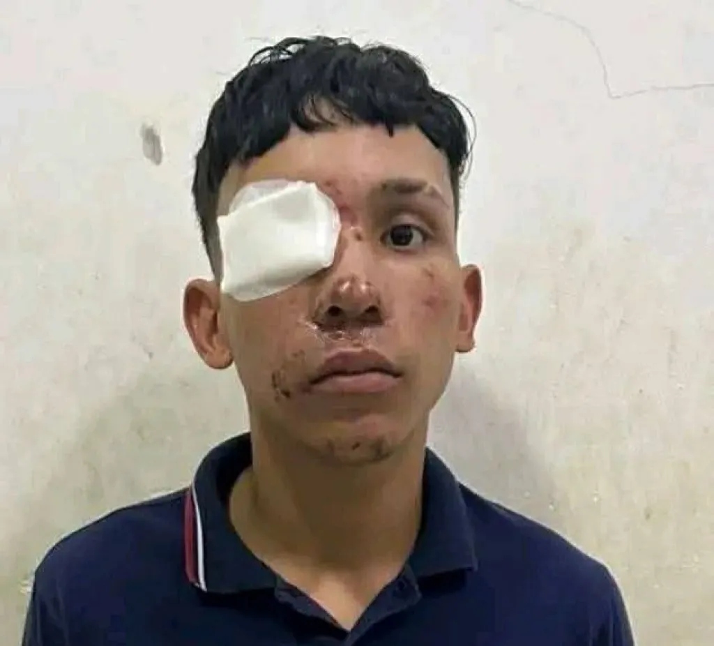 Dituding sebagai Informan, Dua Gadis Bersaudara Diculik lalu Dibunuh Geng