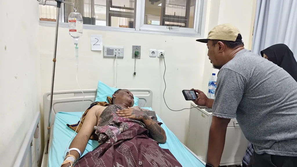 Kesaksian Korban Selamat Ledakan Petasan di Ponorogo, Akui Terpental saat Taruh Kunci Motor