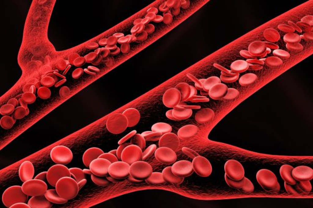  Kadar Hemoglobin Terlalu Tinggi, Ini Penyebabnya