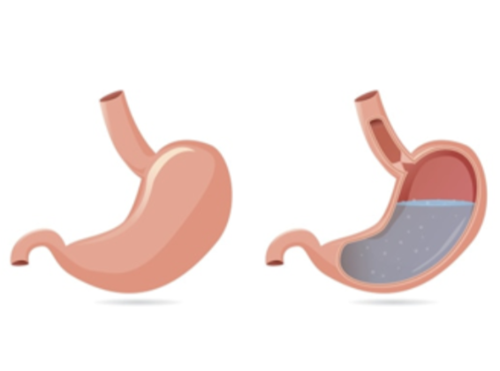 Puasa Ramadhan Bisa Sehatkan Lambung