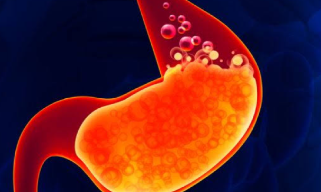 Survey: Puasa Ramadhan Sembuhkan Asam Lambung