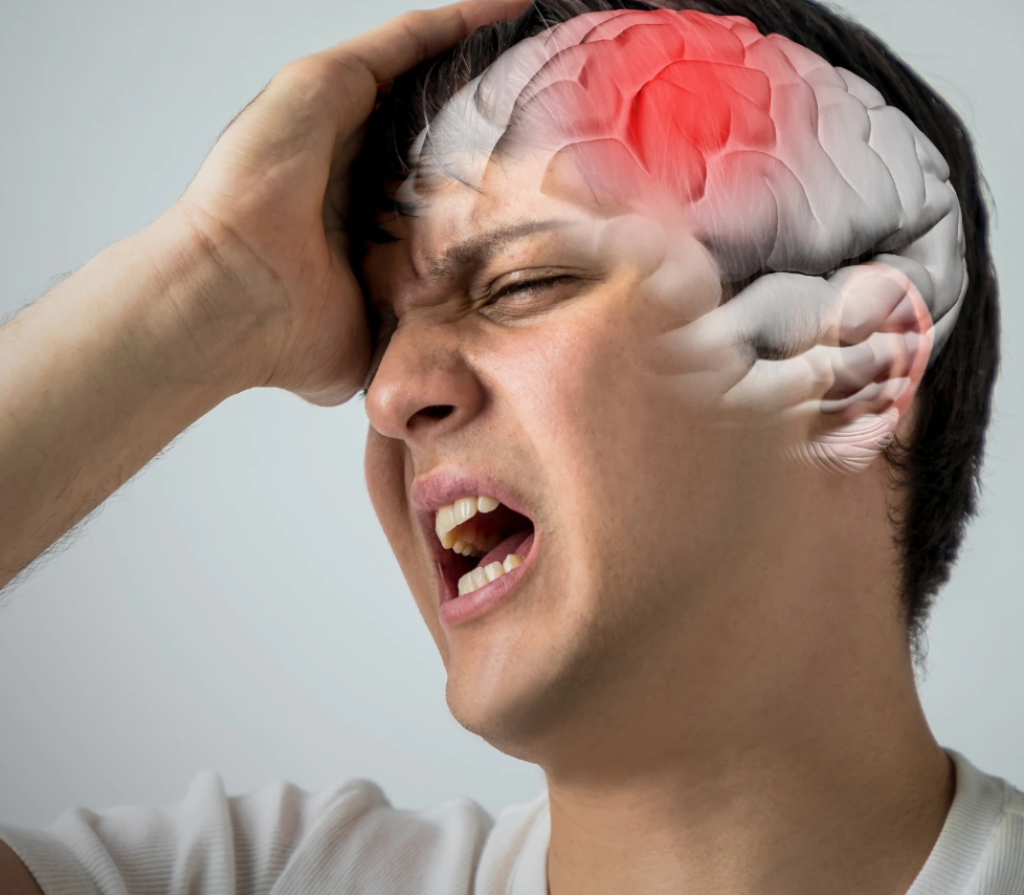 Golongan Darah A Lebih Berisiko Kena Stroke di Usia di Bawah 60 Tahun