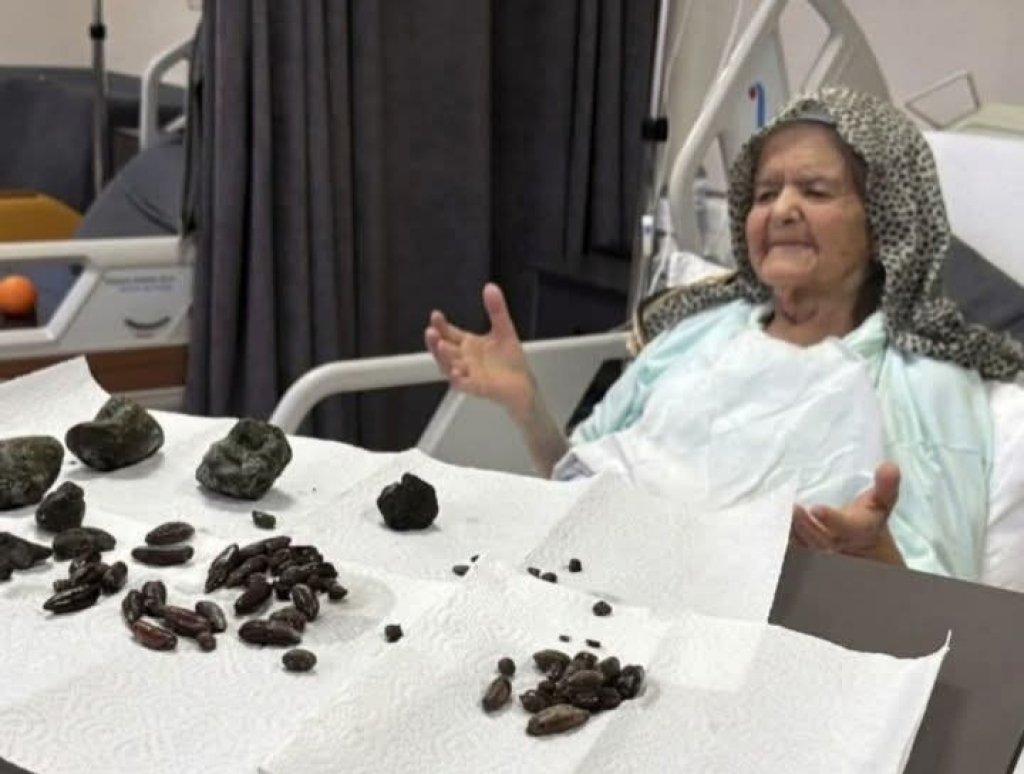 Ditemukan Puluhan Biji Zaitun dan Kurma Dalam Perut Nenek Usia 92 Tahun